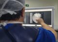 Aumento de cirurgias de quadril no Brasil