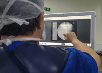 Aumento de cirurgias de quadril no Brasil 