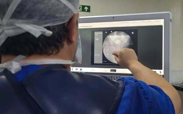 Aumento de cirurgias de quadril no Brasil