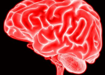 O AVC e a corrida contra o tempo