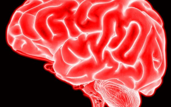 O AVC e a corrida contra o tempo