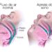 Apneia do sono: ameaça silenciosa à saúde