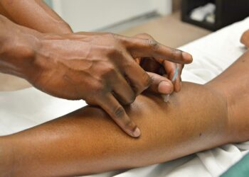 Acupuntura e Auriculoterapia no SUS