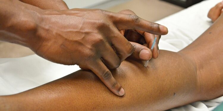 Acupuntura e Auriculoterapia no SUS