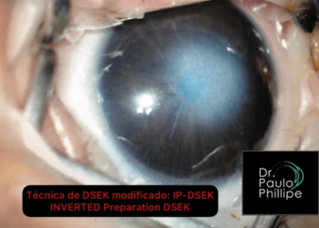 Nova técnica devolve visão a recém-nascida  