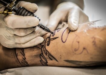 Remoção de tatuagem: vale a pena?