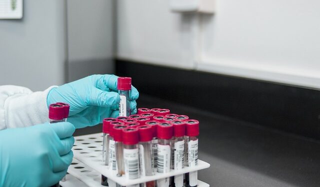 Mais de um terço das mulheres apresentam deficiência de ferro